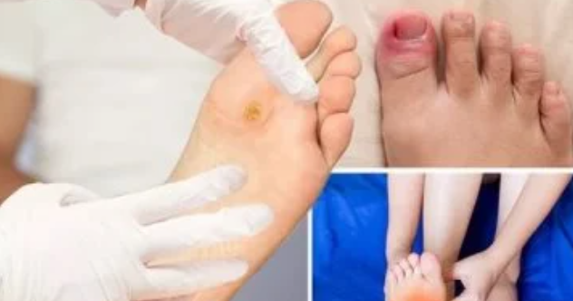 فيروس HFMD عند الكبار: الأعراض والوقاية والعلاج