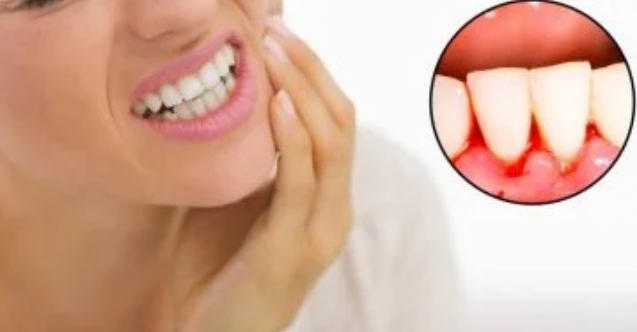 علامات اللثة السليمة ومؤشرات الخطر